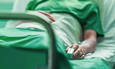 Primera muerte por viruela del mono en México