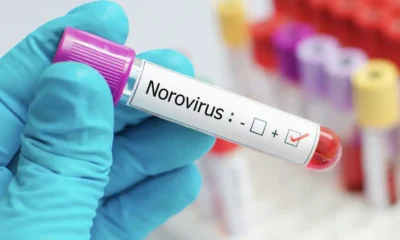 Norovirus golpea EE.UU. y amenaza la frontera
