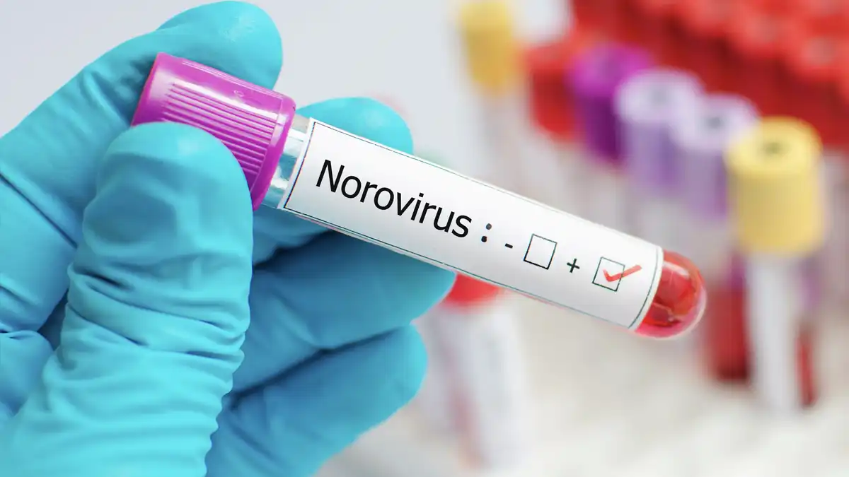 Norovirus golpea EE.UU. y amenaza la frontera